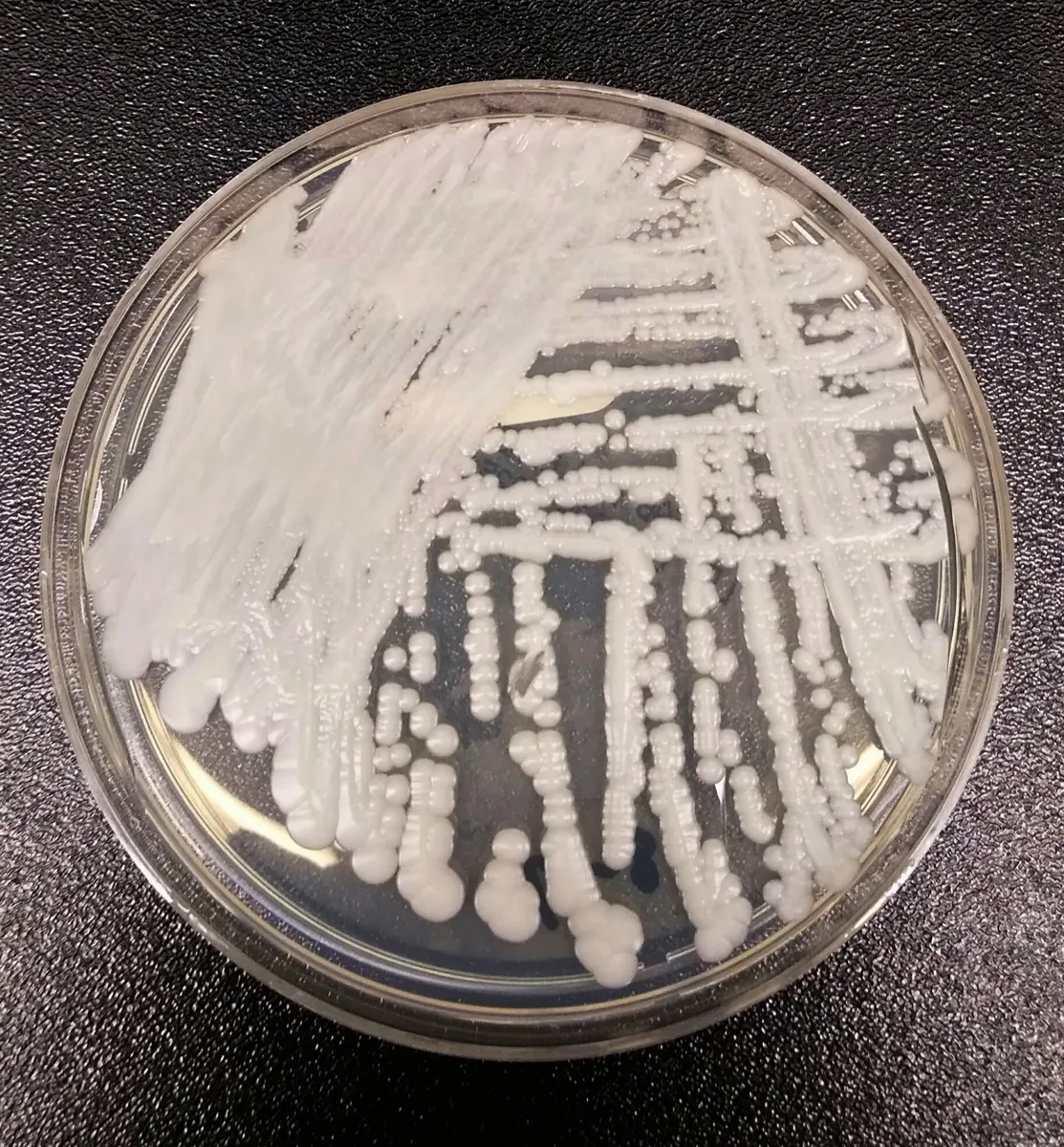 Candida auris. Фото: Wikimedia Commons